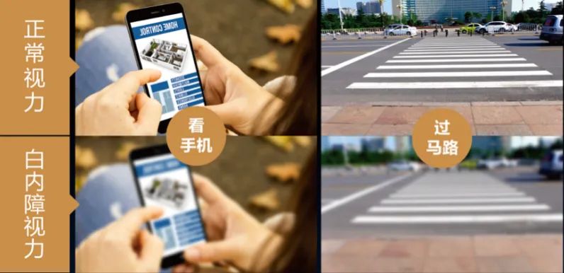 家里老人看不清？得了白内障怎么办？插图