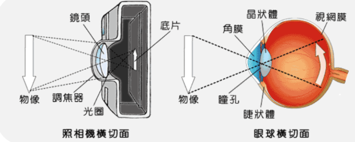 家里老人看不清？得了白内障怎么办？插图(2)