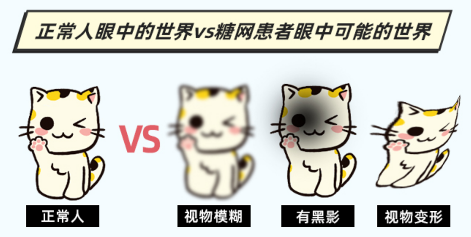 糖尿病患者眼病防控的“小秘方”！插图(1)