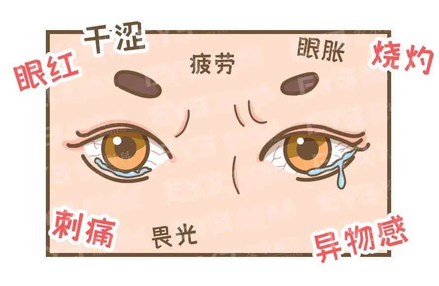 干涩、刺痛、异物感……你的眼睛到底怎么了？插图