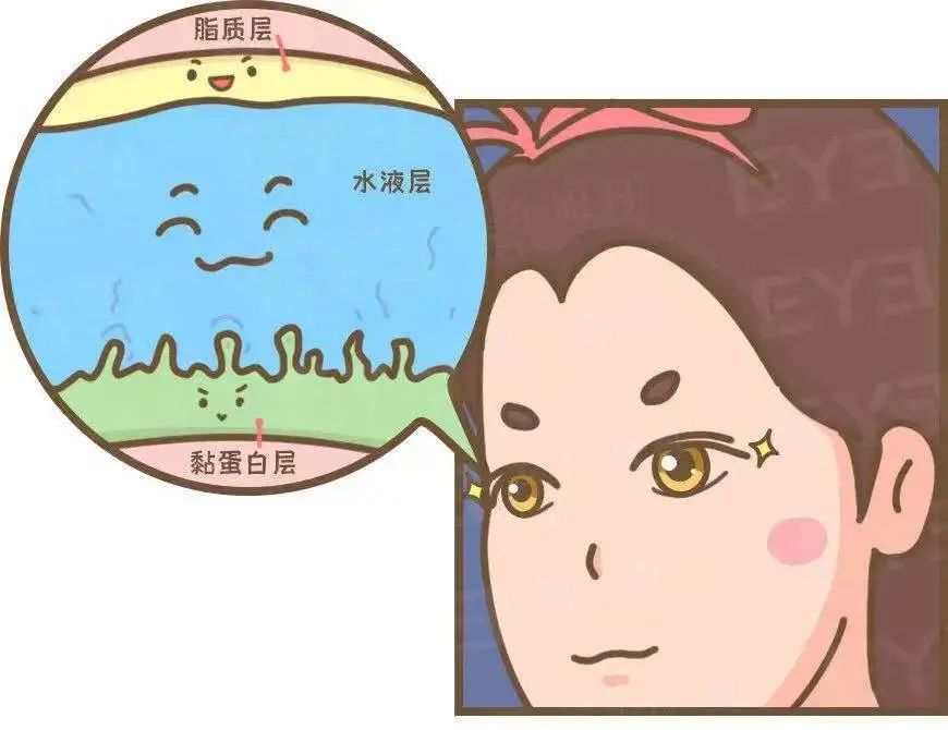 干涩、刺痛、异物感……你的眼睛到底怎么了？插图(1)