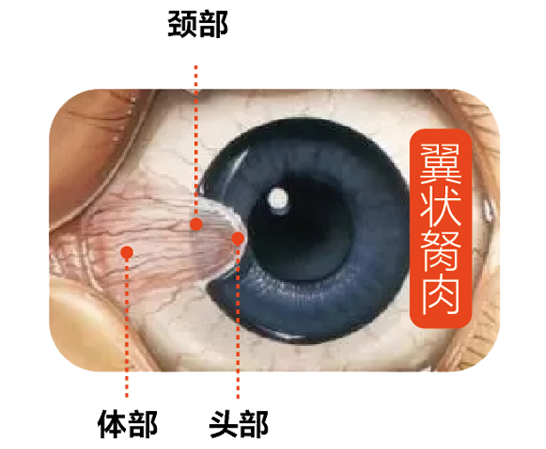 眼球上长肉是怎么回事？会影响视力吗？插图