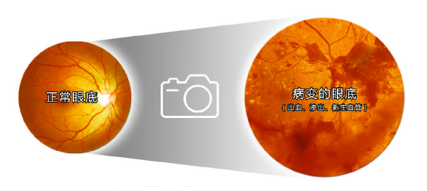 我们为什么要检查眼底呢？插图(1)