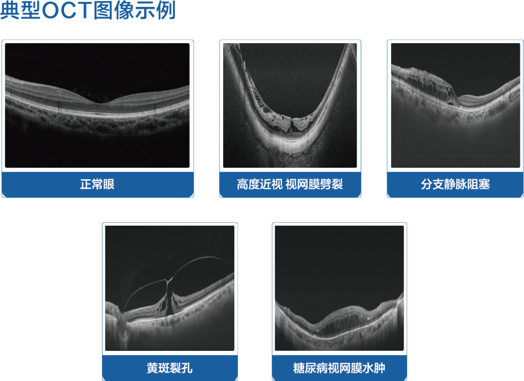我们为什么要检查眼底呢？插图(3)