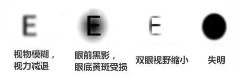 明明我在控制血糖，为什么眼睛还是出问题了？插图