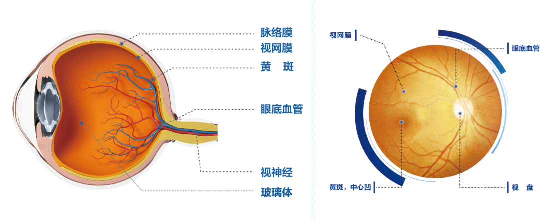 这张“照片”藏着大秘密！这些人不定期查眼底，后果可能很严重插图