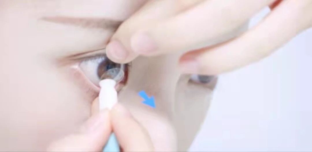 冬季角膜塑形镜怎么保养？插图(8)