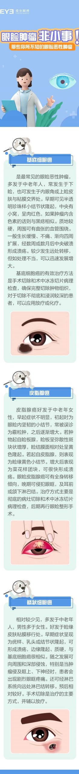 眼睑肿瘤非小事，那些你所不知的眼睑恶性肿瘤插图