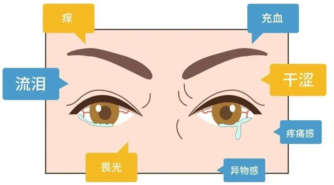 干、干、干！眼睛太干了！到底怎么办？插图