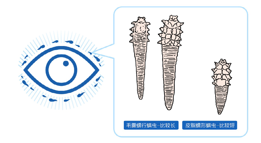 眼睛总是觉得痒？看看是不是这三种情况插图(2)