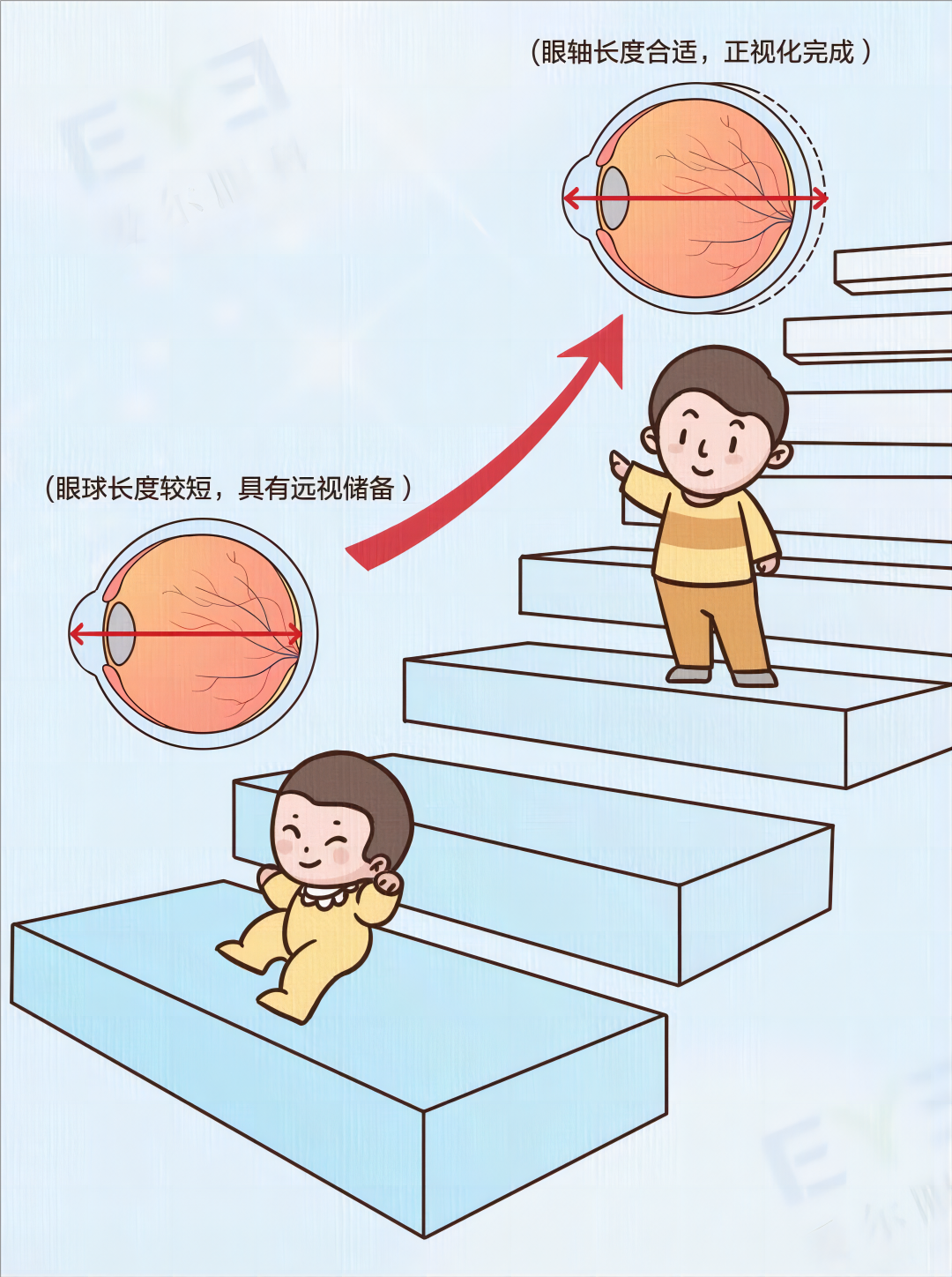网传近视眼800度降到100度的方法，可信吗？插图(2)