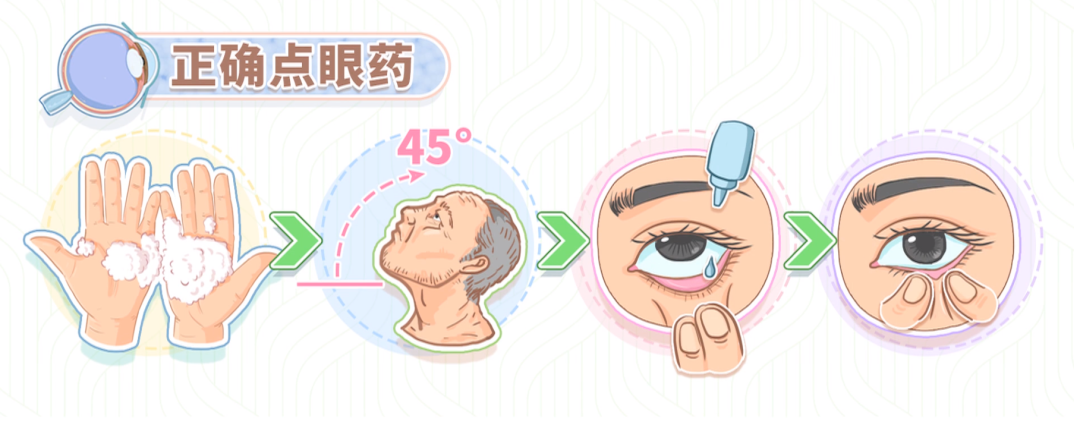 眼药水不要滴在黑眼珠上，还有这些坑也不能踩!插图(1)