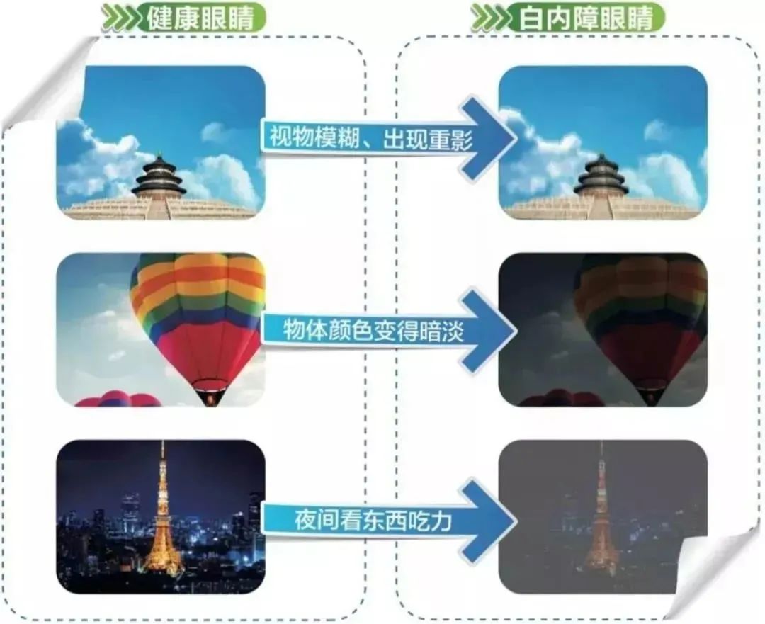 年轻时近视，老了就有福了？插图
