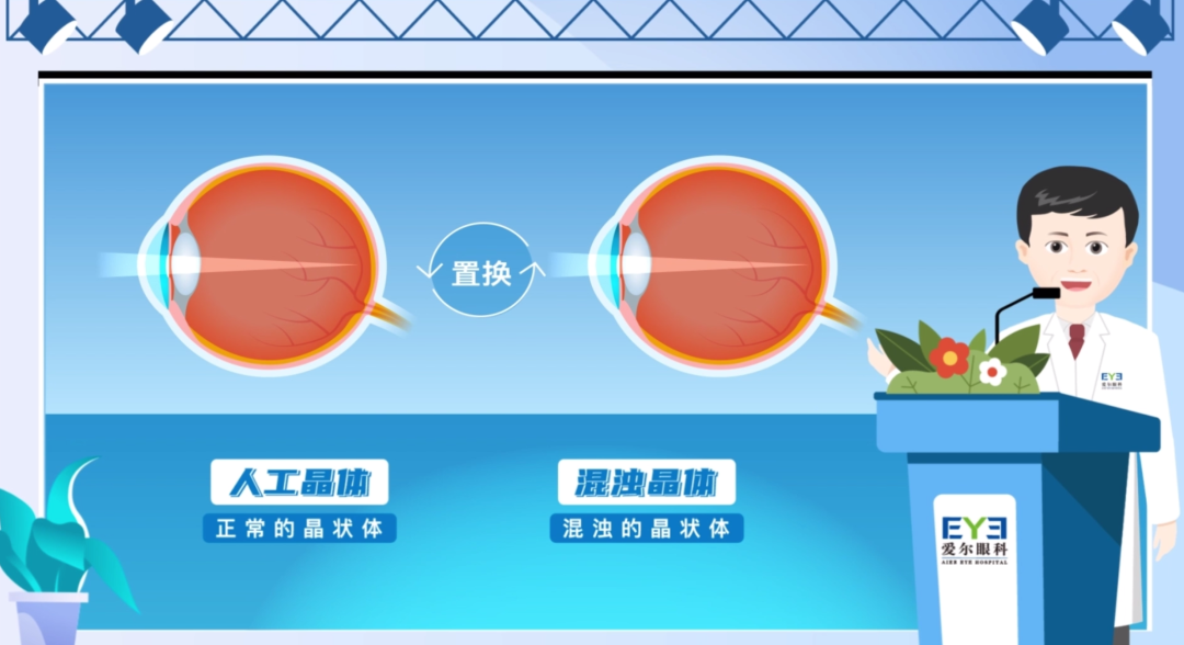 年轻时近视，老了就有福了？插图(1)