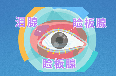 【热搜】男子常熬夜致眼睛成80岁状态！得了干眼症怎么办？插图(3)