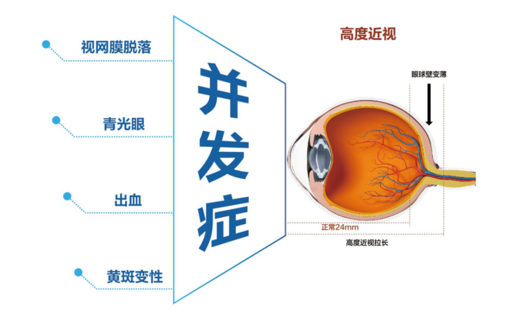 近视600度的你，快点进来看看！插图(2)