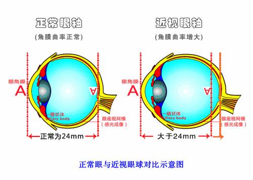 儿童弱视，家长们要尽早了解一下~插图(1)