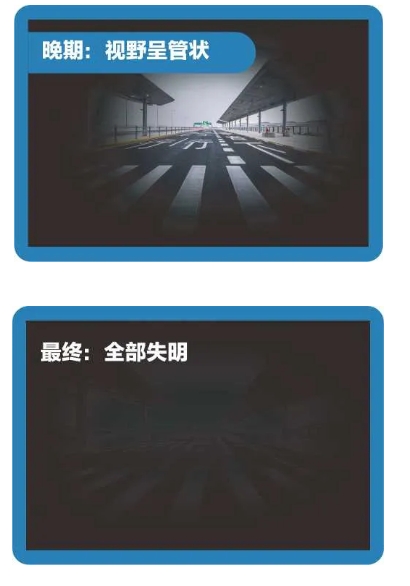 青光眼会不会遗传给下一代？插图(1)
