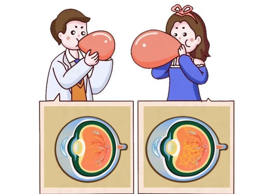 近视600度的你，快点进来看看！插图(1)
