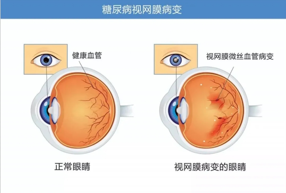 五一别“甜”过头！如何不被这张“网”粘住！插图