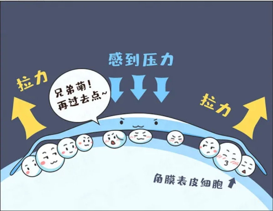 为什么验配角膜塑形镜需要到专业眼科医院？插图(1)
