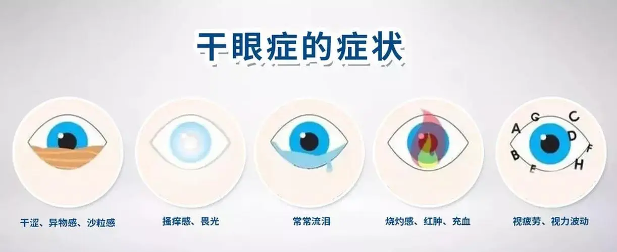 每天8小时对着电脑，这4个缓解干眼症妙招请收好插图