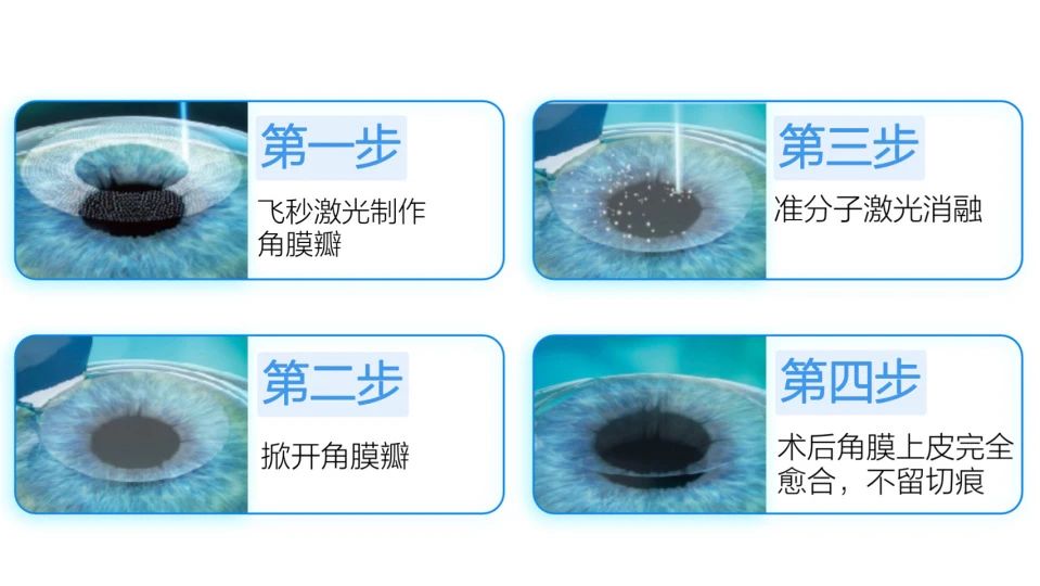 全飞秒VS半飞秒，究竟哪个好？插图(2)