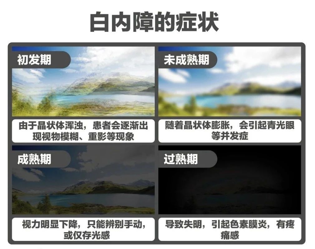 白内障为什么会出现这些症状？插图
